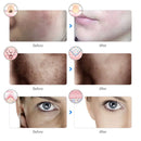 Máscara de beleza facial com LED